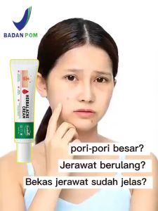 BPOM Obat Herbal Alami JERAWAT: Mengatasi Jerawat dan Bekas Jerawat, Melembutkan Permukaan Kulit dan Mengurangi Gatal