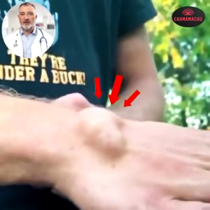 gout ointment Natural Chinese herbal medicine gout ointment wrist pain back pain knee pain relief Treatment thumb