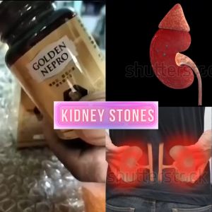 ORIGINAL GOLDEN NEPRO: A NATURAL SOLUTION FOR KIDNEY STONE BREAKER & DETOXIFICATION SUPPORT