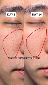 Eqqualberry Bakuchiol Plumping Serum (30ml)