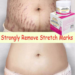 妊娠纹去除霜Kelahiran Tanda Pembuangan CreamPregnancy Mark Removal Cream for Prevention of Pregnancy Mark Skin Repair Cream 150g to remove fat marks and growth marks