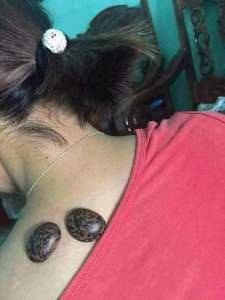 HẠT ĐẬU LÀO DÙNG ĐỂ HÚT ĐỘC