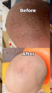 FORA NATURE -  Minyak Jojoba Untuk Bantu Kelupas Kerak Kepala Bayi 20ml