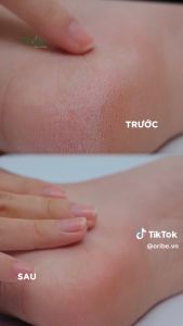 [Combo 3 Hộp] Kem nứt gót Oriss dưỡng ẩm làm mềm gót chân làm liền vết thương 30g