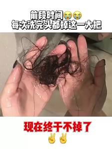 💗🙋‍♀️💗头皮上器育发梳米诺滚珠导入梳红蓝光育发液头部按摩给器代发