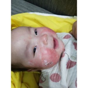 KEM BÔI DA MINH HÙNG CHÍNH HÃNG DATE 2027