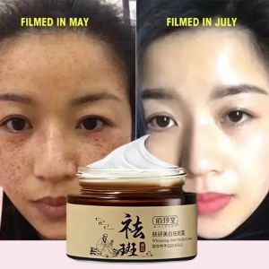 Efektif Whitening Freckle Cream Menghapus Melasma Jerawat Bintik Gelap Pigmentasi Kulit Kulit 30g