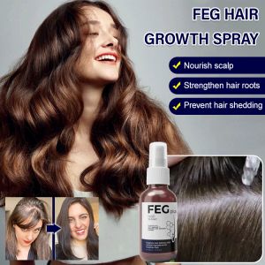 FEG Hair Growth Essence Spray Hair Growth Nutrient Solution Fast Promotes Hair Growth Effective Anti Hair Loss Preventiom Prevents Balding
