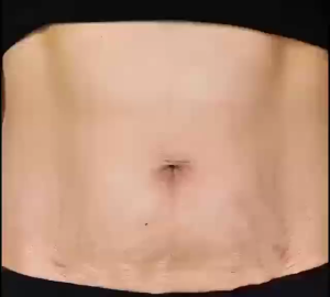 Stretch Marks CreamPregnancy Cream 120gMaternity Skin RepairRemove Pregnancy Scars TreatmentFirming BodyEliminate Growing MarksAnti Wrinkle Anti Aging