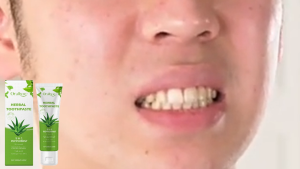 ยาสีฟันสมุนไพร 5-in-1 สูตรเปปเปอร์มิ้นต์ ขจัดคราบสกปรก ฟันขาวสดชื่น ลดอาการเสียวฟัน 100g