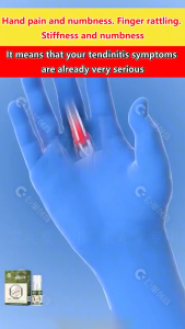 APGAR Tenosynovitis Heel Pain Spray joint spray tenosynovitis type cold compress gel tenosynovitis heel pain spray