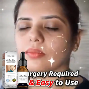 Kadaie Eelhoe Wart Removal: Esensi Penghilang Kutil Mudah Dibawa