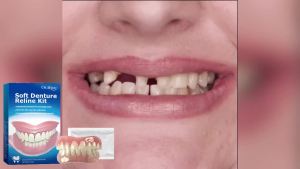 Denture Reline Kit Silicone Liners Soft Denture Braces Silicone Whitening Teeth Cover Teeth Bracesc Comfortable Teeth