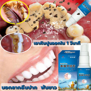 ยาสีฟัน ZHOURUNAN ผ่าตัด 30ML กลิ่นปาก ขจัดคราบหินปูน ลดช่วยให้ฟันขาวขึ้นแบบธรรมชาติ 100% ถูกช้ ในการปรับปรุงผิวหน้า