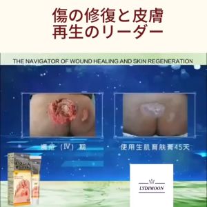Japan Bedsore Cream 20g Wound Healing Decubitus Feet Care Ointment Pressure Sore Ulcer Rapid Treatment of Bed Sore/Diabetic Feet/Skin Rot Necrotic/Surgical Wounds