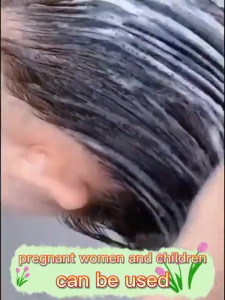 Childrens Shampoo Adult Lice Spray Lice Shampoo Head Lice Care Shampoo Gentle And Non-Irritating Quickly Removes Dandruff Relieves Itching And Eliminates Mites Quickly Kills Head Lice Pubic Lice Larvae And Lice Eggs 200 Ml
