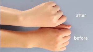 Body Lotion Collagen Whitening Anti-Wrinkle Anti-Aging Moisturizing Body Lotion Remove Chicken Skin 300g