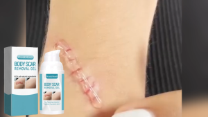 Scar Removal Cream Burn Surgery Scar Repair Cream Smooth Brightening Skincare Fade Acne Scars Remove Stretch Marks Restore Skin