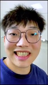 Pasta Penghilang Karang Gigi Pasta Gigi Charcoal / Pemutih Gigi Kuning / Odol Pemutih Gigi - BISA COD