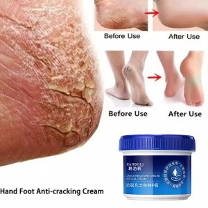 Hand Foot Crack Cream/Dry Rough Cracked Heel Cream/Repair Dry Cracked Feet Hands Foot Cream/Heel Balm for Rough Hands And Feet Dry Skin Repair Anti Crack Cream/Heel Chapped Peeling Foot and Hand Repair/Foot Moisturizer for Repair Cracked Anti Chapping
