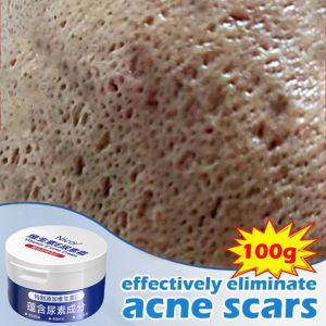 Penghilang bekas jerawat Krim wajah obat lubang jerawat 100g Vitamin E krim pemutih Pelembab