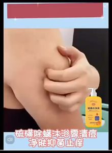 Sulfur Anti-mite Liquid Soap Control Oil Acne Acne Moisturizing Net Mite Sulfur Body Wash硫磺净满沐浴露清洁滋润背后痘控油字眼皂液