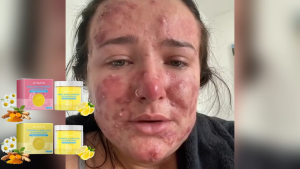 Jaysuing  Kojic Acid Turmeric Cotton Pads   Gentle Cleansing Skin Exfoliating Soft Soothing Facial Cleansing Pad