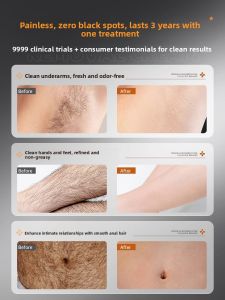 Algn | Full Body Hair Removal Cream For Men Armpit Leg Underarm Hair Removal Gel Permanent No Repeated Use Convenient Tool