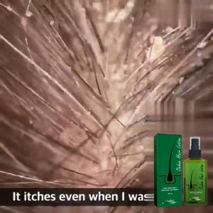OUHOE 100% original 120ML hair gel for hair transplantation and hair loss treatment green original GMP certification