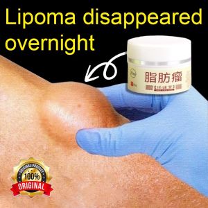 Lipoma removal Cream lipoma cream 脂肪瘤 30g Fat Granule Care Removing Multiple Single Lipoma Subcutaneous Lipoma Treat Tumor Skin Swelling Ointment Treat Tumor Skin Swelling Ointment
