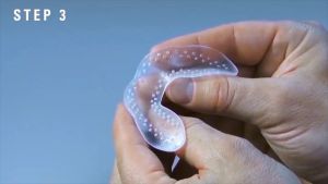 LunaGuard Nighttime Dental Guard | Bruxism Mouthguard Mouth For Anti Grinding Teeth Tooth Protector Night Sleeping Pelindung Gigi 防磨牙套