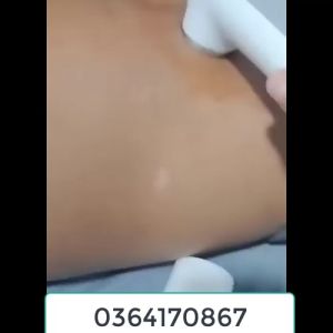 SIÊU ÂM CHÍNH HÃNG GYCS-01