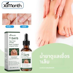 น้ำยาบำรุงเล็บเท้า แก้ปัญหาเล็บขึ้นรา เล็บขุ่น เล็บหนา เล็บเปลี่ยนสี กำจัดโรคเชื้อราที่เล็บและเล็บข้างเล็บ น้ำมันบำรุงเล็บต้านเชื้อรา
