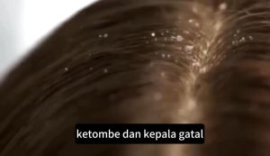 Kelapa Shampoo Kelapa Shampoo anti ketombe sampo Singkirkan Ketombe Memperbaiki Kulit Kepala Yang Gatal Pembersihan Mendalam
