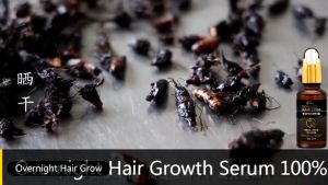 Penumbuh Rambut Botak & Kontrol Minyak Rambut