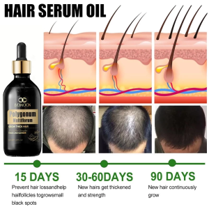 Hair Growth Serum Hair Nourishing Liquid 50ml Anti-Hair Loss Essence Toughness Root Activates Hair Follicle Promoting Hair Growth Hair Tonic For Hair Density Hair Growth Care