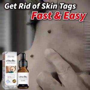 Penghilang Tahi Lalat & Kutil: Menghilangkan Pigmen Hitam & Flek\\n\\n Apa itu Liwenyan Penghilang Tahi Lalat?\\nLiwenyan adalah produk yang dirancang khusus untuk menghilangkan tahi lalat, pigmen hitam, flek, dan bintik pada kulit. Produk ini telah terbukti efektif dalam memperbaiki penampilan kulit dan meningkatkan kepercayaan diri penggunanya.\\n\\n Manfaat Liwenyan dalam Menghilangkan Tahi Lalat\\nDengan menggunakan Liwenyan, Anda dapat mengharapkan beberapa manfaat berikut:\\n\\n* Menghilangkan tahi lalat dengan cepat dan aman\\n* Membantu meratakan warna kulit\\n* Meningkatkan kepercayaan diri\\n* Memperbaiki penampilan kulit secara keseluruhan\\n\\n Cara Kerja Liwenyan dalam Menghilangkan Tahi Lalat\\nLiwenyan bekerja dengan merangsang pembentukan sel-sel baru pada kulit, sehingga membantu menghilangkan tahi lalat dan flek. Komposisi unik Liwenyan membuatnya menjadi pilihan yang aman dan efektif untuk mengatasi masalah tersebut.\\n\\n Menghilangkan Pigmen Hitam & Flek\\nPigmen hitam dan flek pada kulit seringkali disebabkan oleh paparan sinar matahari, genetika, atau proses penuaan. Menggunakan Liwenyan dapat membantu mengurangi dan bahkan menghilangkan pigmen hitam dan flek tersebut.\\n\\n Penyebab Pigmen Hitam & Flek pada Kulit\\nBeberapa faktor yang dapat menyebabkan pigmen hitam dan flek pada kulit antara lain:\\n\\n* Paparan sinar matahari\\n* Genetika\\n* Proses penuaan\\n* Penggunaan obat-obatan tertentu\\n\\n Metode Menghilangkan Pigmen Hitam & Flek dengan Liwenyan\\nUntuk menghilangkan pigmen hitam dan flek pada kulit, ikuti langkah-langkah berikut:\\n\\n1. Bersihkan area yang akan diobati dengan sabun dan air hangat.\\n2. Oleskan Liwenyan secara tipis pada area yang diinginkan.\\n3. Biarkan Liwenyan bekerja selama 15-20 menit.\\n4. Bersihkan area tersebut dengan air hangat dan handuk bersih.\\n\\n Menghilangkan Kutil di Leher & Muka\\nKutil di leher dan muka dapat menjadi sangat mengganggu dan tidak nyaman. Menggunakan Liwenyan dapat membantu menghilangkan kutil tersebut dengan cepat dan aman.\\n\\n Penyebab Kutil di Leher & Muka\\nBeberapa faktor yang dapat menyebabkan kutil di leher dan muka antara lain:\\n\\n* Infeksi virus HPV\\n* Kurangnya kebersihan\\n* Kontak langsung dengan penderita kutil\\n\\n Metode Menghilangkan Kutil dengan Liwenyan\\nUntuk menghilangkan kutil pada leher dan muka, ikuti langkah-langkah berikut:\\n\\n1. Bersihkan area yang akan diobati dengan sabun dan air hangat.\\n2. Oleskan Liwenyan secara tipis pada area yang diinginkan.\\n3. Biarkan Liwenyan bekerja selama 15-20 menit.\\n4. Bersihkan area tersebut dengan air hangat dan handuk bersih.\\n\\n Tips dan Trik Penggunaan Liwenyan\\nBerikut adalah beberapa tips dan trik penggunaan Liwenyan yang dapat membantu Anda mendapatkan hasil terbaik:\\n\\n Cara Menggunakan Liwenyan dengan Benar\\n1. Pastikan area yang akan diobati bersih dan kering sebelum menggunakan Liwenyan.\\n2. Oleskan Liwenyan secara tipis pada area yang diinginkan.\\n3. Biarkan Liwenyan bekerja selama 15-20 menit.\\n4. Bersihkan area tersebut dengan air hangat dan handuk bersih.\\n\\n Dampak Positif Penggunaan Liwenyan\\nMenggunakan Liwenyan dapat membawa beberapa dampak positif bagi kulit Anda, termasuk:\\n\\n* Mengurangi dan bahkan menghilangkan tahi lalat, pigmen hitam, flek, dan bintik\\n* Membantu meratakan warna kulit\\n* Meningkatkan kepercayaan diri\\n* Memperbaiki penampilan kulit secara keseluruhan\\n\\nJadi, jika Anda mencari solusi aman dan efektif untuk menghilangkan tahi lalat, pigmen hitam, flek, dan bintik pada kulit, Liwenyan adalah pilihan yang tepat untuk Anda. Coba sekarang dan rasakan perbedaannya!\"