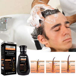 Anti Hair Loss Shampoo Hair Growth Shampoo For All Types Of Hair 250ML