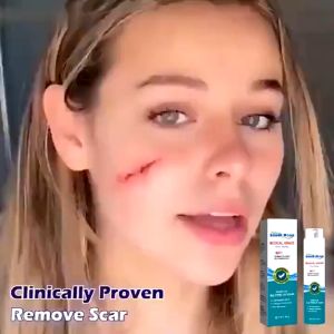 Penghilang Bekas Luka & Scar Keloid: Solusi Profesional