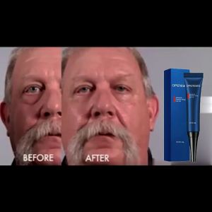 Eye Bag Remover for Men Eye Cream for Dark Under Eye Wrinkle Remover for Men for Women Eyecream for Men for Day and Night Use