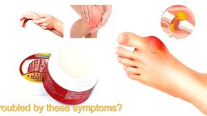 Kem Thảo Dược Chăm Sóc Xương Khớp Giảm Sưng Đau Gout và Xẹp Tophi