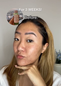 Farmacy Deep Sweep Pore Cleaning Toner - BHA Toner | Exfoliating | Alcohol-free | Combination | Oily | Acne-prone Skin