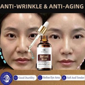 LYDIMOON Anti-Wrinkle Eye Essence Oil 30ml Eye Essence Oil Eye Cream Anti-aging Remover Dark Circles Eye Care Hydrating Fade Fine Lines 60s Instantly Eye Bag Removal Cream Anti Puffiness Wrinkles抗皱精油