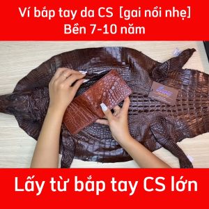 Bóp ví da bắp tay cá sấu [GAI NỔI NHẸ SIÊU ĐẸP]