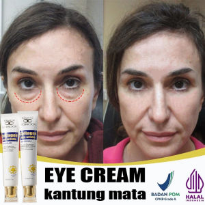 Eye Cream Untuk Kantung Mata & Kerutan Mata