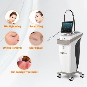 OEM CO2 Fractional Laser Machine Fontona scar removal machine Fractional Laser CO2