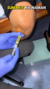 Gout Joint Repair Patch: Dissolve Crystals Ease Pain & Soothe Redness Instantly