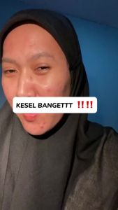 Masker Wajah Stik Glad2Glow Salicylic Acid Anti Acne & Pores - Masker wajah glowing dan putih/Masker wajah komedo dan pori/Masker wajah mencerahkan/Masker wajah jerawat