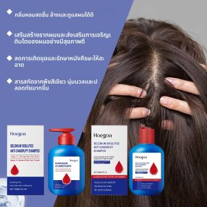 ซีลีเนียมไดซัลไฟด์แชมพูป้องกันรังแคทําความสะอาดลึกหนังศีรษะอาการคันบรรเทาลดสารร่อนน้ํามันแชมพูผมนุ่มสดชื่น