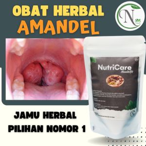 7 Hari Atasi Amandel Obat amandel untuk anak2 paling ampuh amandel orang dewasa amandel anak kempes amandel tanpa operasi sakit tenggorokan dewasa sakit tenggorokan radang tonsilitis akut tonsilitis kronis radang amandel kelenjar getah bening bengkak